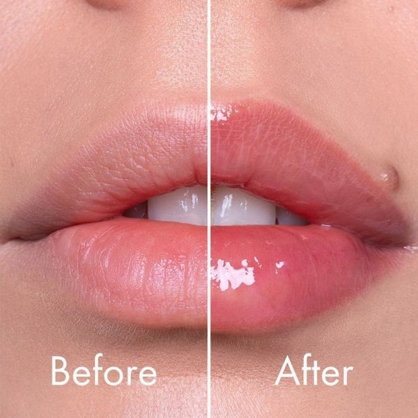 Плампер для губ з мікроголками VT Cosmetics Reedle Shot Lip Plumper Beginner 12844 фото