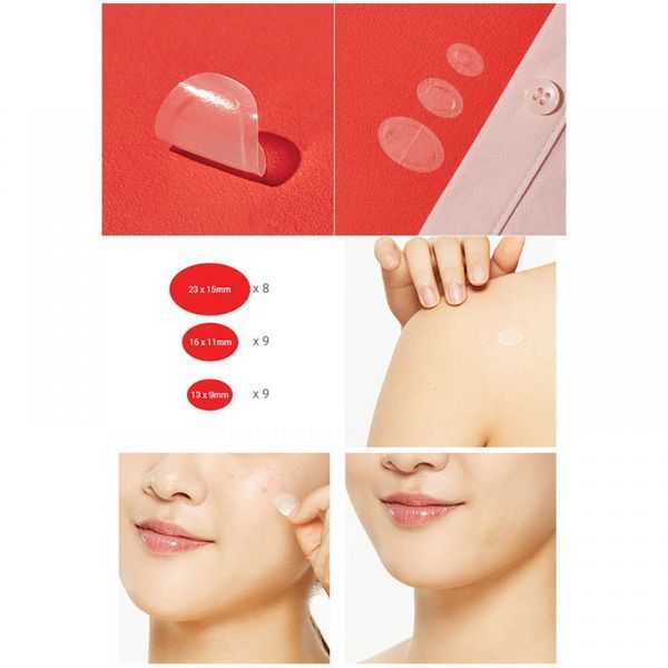 Лечебные патчи от воспалений с центеллой азиатской Cosrx AC Collection Acne Patch 12946 фото