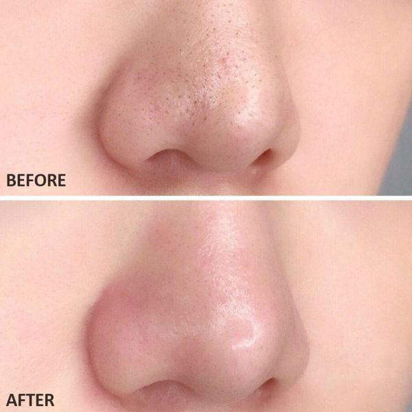 Глиняна маска-стік для обличчя Skin1004 Madagascar Centella Poremizing Quick Clay Stick Mask 12586 фото