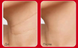 Лифтинг-стк для шеи и декольте с пептидным комплексом  Medi-Peel Premium Naite Thread Neck Stickи 11452 фото 3