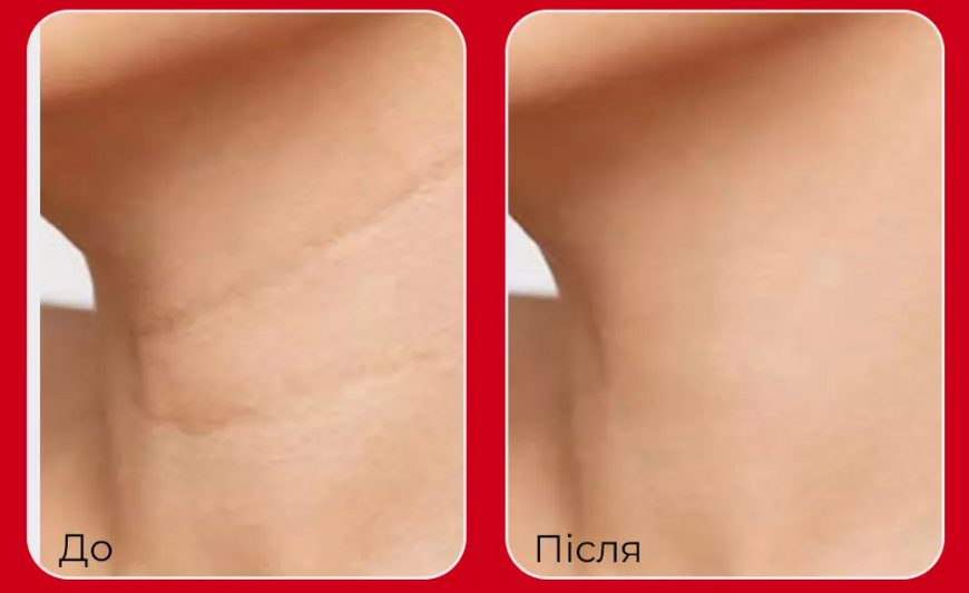 Лифтинг-стк для шеи и декольте с пептидным комплексом  Medi-Peel Premium Naite Thread Neck Stickи 11452 фото