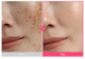 Осветляющая сыворотка с транексамовой кислотой Purito TXA 6 Niacinamide 10 Retinal Serum 13210 фото 3