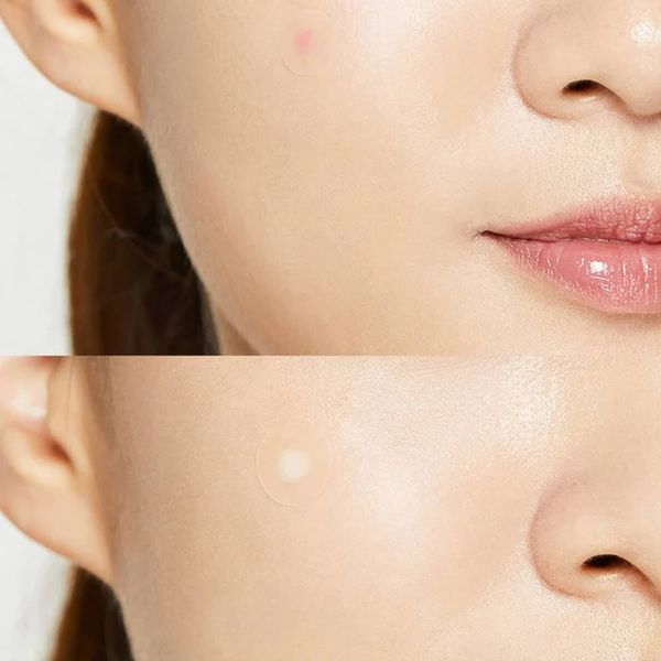 Точечные патчи от акне Cosrx Acne Pimple Master Patch 11325 фото