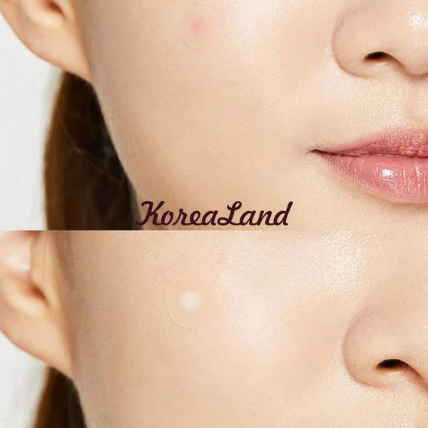 Точечные патчи от акне Cosrx Acne Pimple Master Patch 11325 фото
