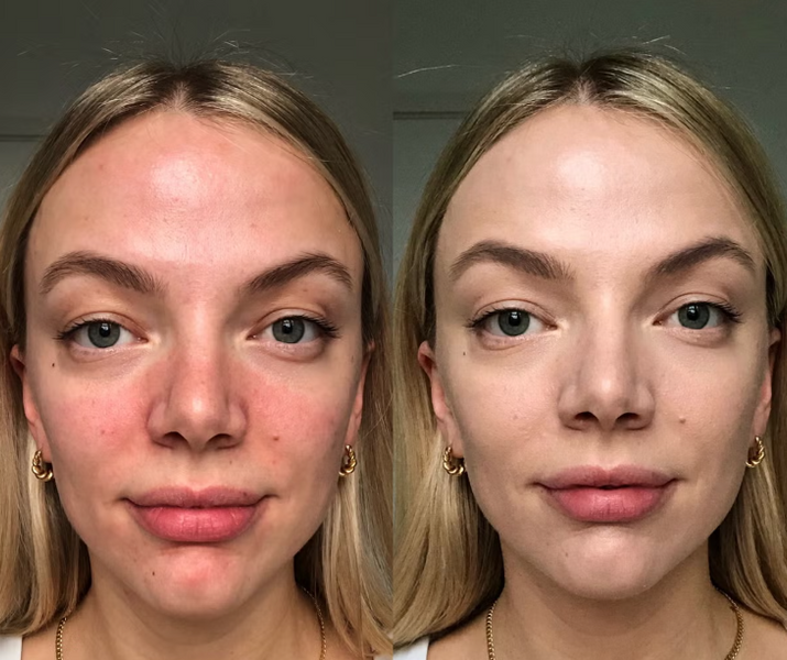 СС крем для нейтрализации покраснений кожи Dr.Jart+ Cicapair Tiger Grass Color Correcting Treatment 13001 фото